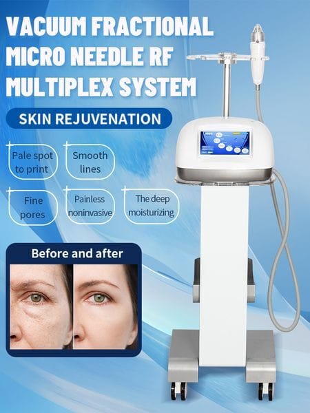 Portable Facial Radio Frequency Vacuum Rf Skin Tightening Rf Microneedle Lines Reducing Wrinkle Removal